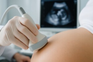Ręka w rękawiczce trzyma głowicę ultrasonograficzną na brzuchu ciążowym i wykonuje USG płodu