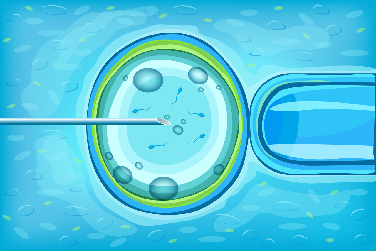 Procedura in vitro realizowana przez kliniki